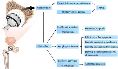 Regulatory signaling pathways of osteoblast autophagy in periprosthetic osteolysis